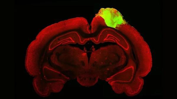 ثبت دقیق ترین تصویر سلول های مغز با یک میکروسکوپ مینیاتوری ، عکس