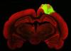 ثبت دقیق ترین تصویر سلول های مغز با یک میکروسکوپ مینیاتوری ، عکس